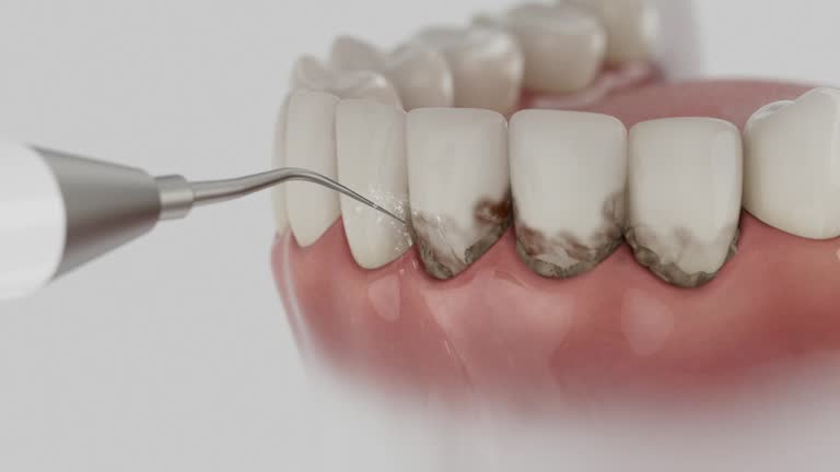 Reliable Dental contractor in Nelsonville, OH by Dentist Open Now